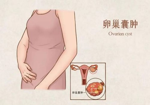 内膜薄的原因汇总，激素紊乱、肥胖均在其中