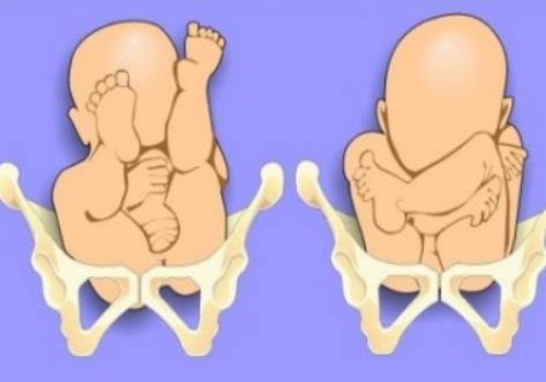 孕妇揉合谷的益处不可不知，赶紧按起来吧！