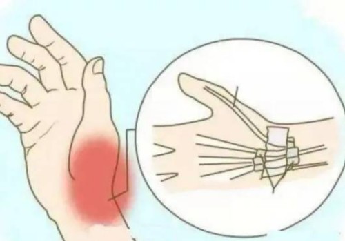 女性免费申请精子受孕允许吗,国内不允许单身女性人工授精